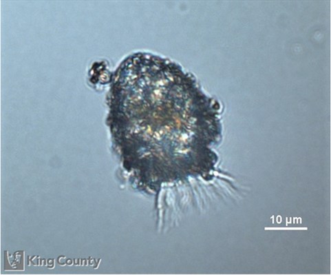 Photo of Tintinnopsis